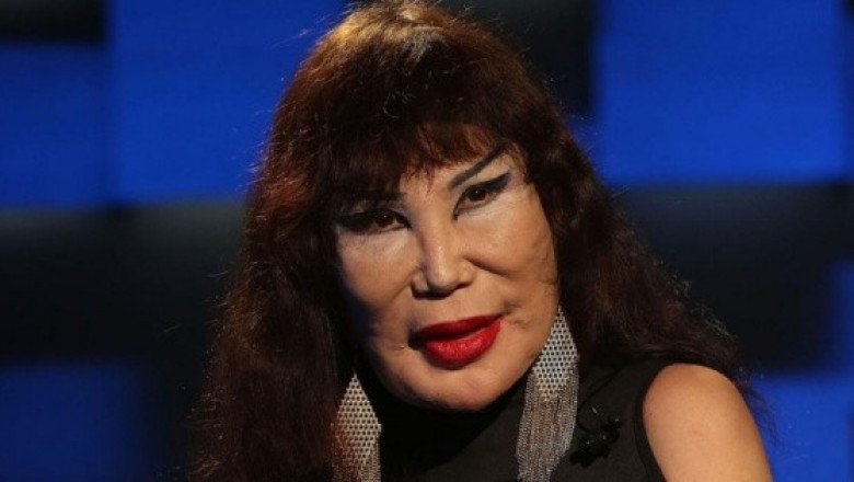Lyn May impacta en redes con invitación para tratamiento de botox