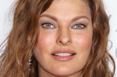 ¿Qué es la hiperplasia adiposa paradójica (HAP) que sufre Linda Evangelista?