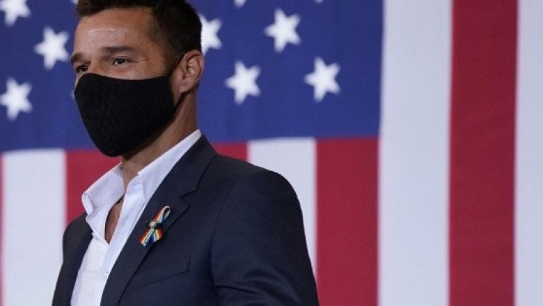 Ricky Martin asegura que no se ha hecho retoques faciales