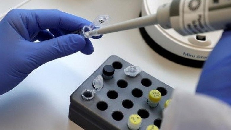 Suman 692 muertes por COVID-19 en Jalisco