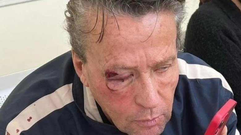 Estas son todas las peleas callejeras que ha protagonizado Alfredo Adame (VIDEO)