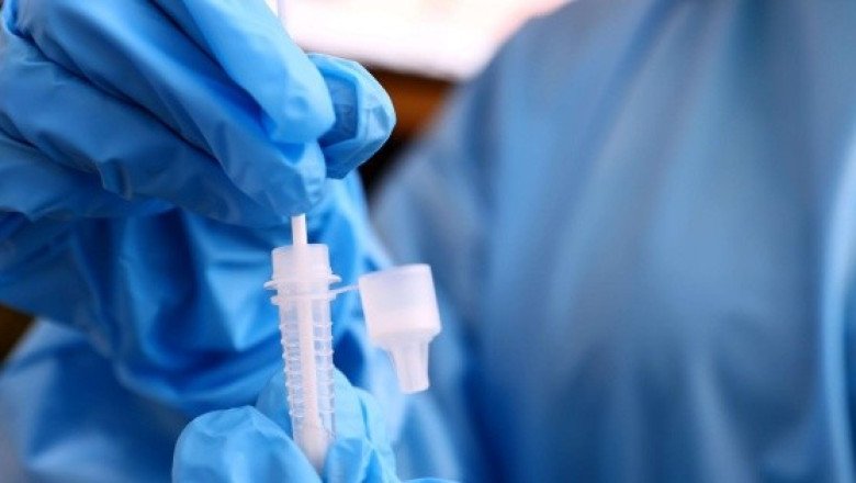 ¿Qué es la meningitis y cómo se contagia?