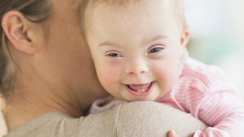 Cada vez nacen menos bebés con síndrome de Down, por estas polémicas razones