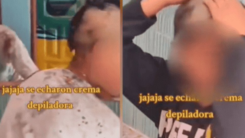 Niños confunden crema para depilar con champú y quedan pelones (VIDEO)