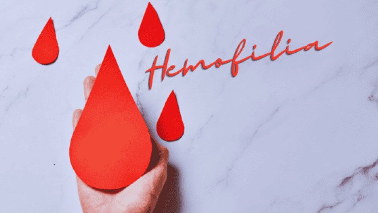 ¿Qué es la hemofilia y cuántos casos hay en México?