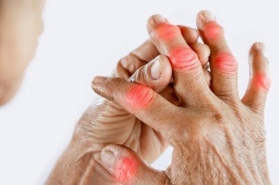 Osteoartritis afecta a seis de cada 10 mexicanos y empeora con el frío