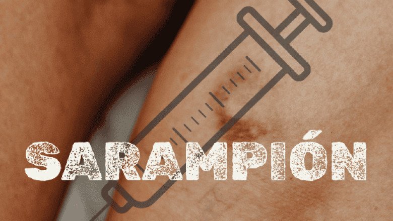 Brote de sarampión en México: dónde aplicarle la vacuna de forma gratuita