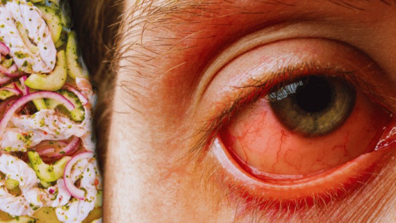 Así es el extraño virus de los mariscos que está causando daños visuales