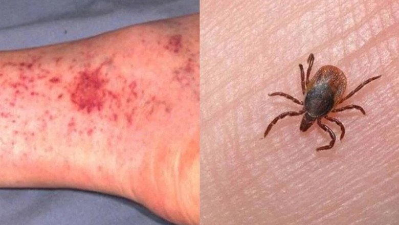 Exhorta gobierno a la ciudadanía a sumarse a la prevención de la rickettsiosis