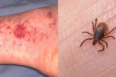 Exhorta gobierno a la ciudadanía a sumarse a la prevención de la rickettsiosis