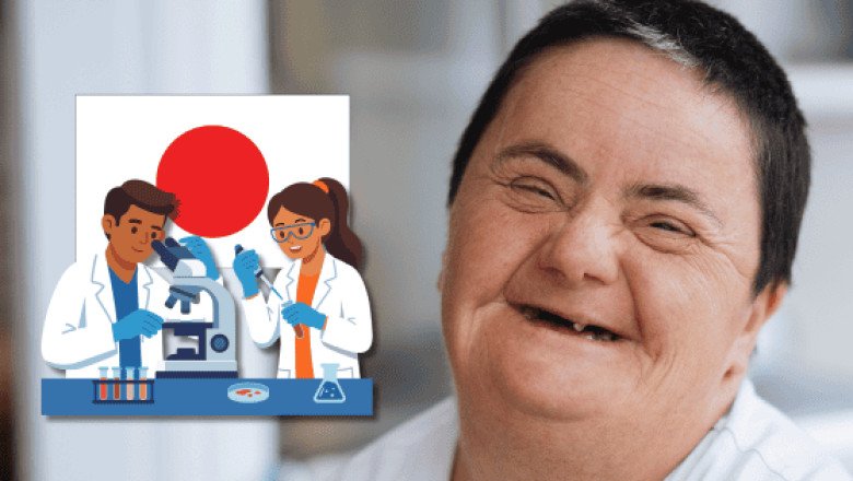 Síndrome de Down: científicos japoneses "inactivan" cromosoma que lo provoca